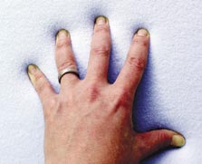 A hand applying pressure to temper foam