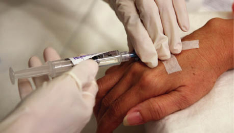 Intravenous injection Intravenous injection