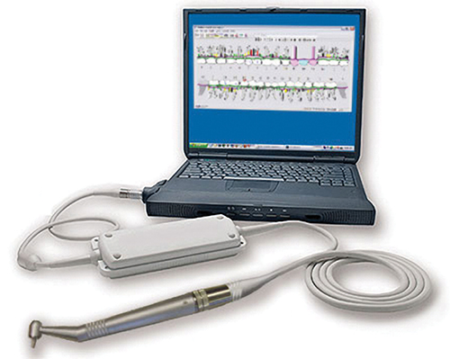 The USProbe device integrates with a laptop computer charting system