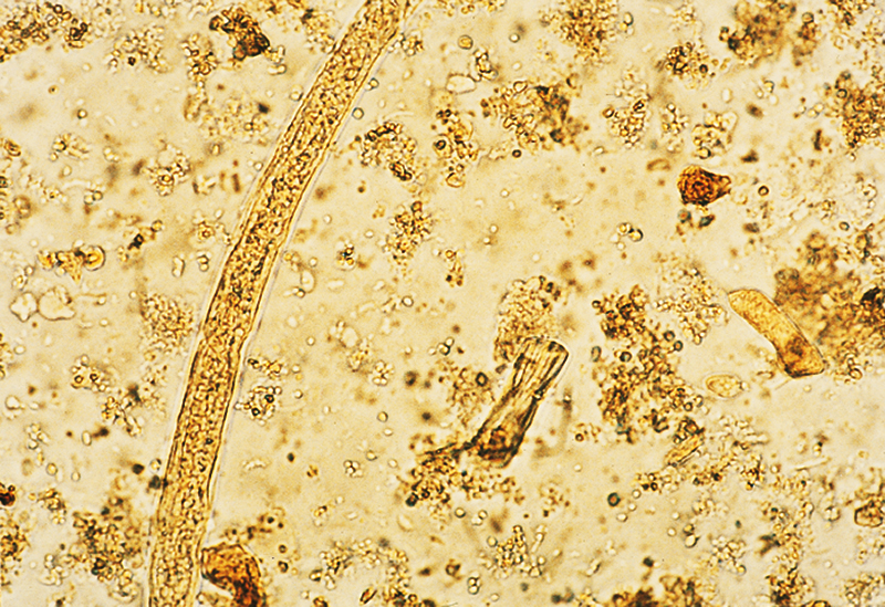 Parasites in a fecal sample (at a magnification of 100 power)