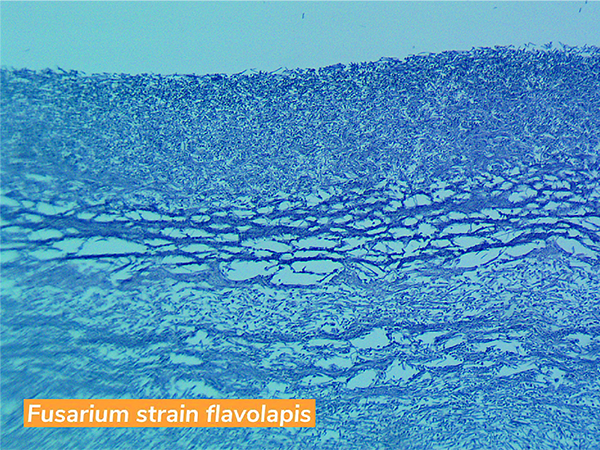 Microscopic image of Fusarium strain flavolapis
