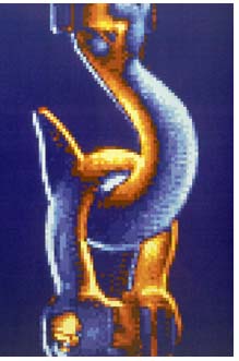 Infrared image of a chain hook, and the temperature changes that correspond to dynamic stress in a structure.  The stressed areas appear yellow against the blue chain