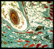 microscopic image of a skin pathology sample from a rabbit
