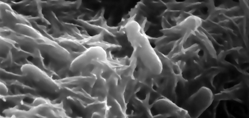 Enlarged image of Shewanella oneidensis bacteria