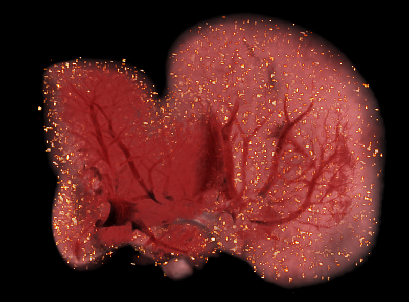A CryoViz image showing tagged stem cells in a mouse liver