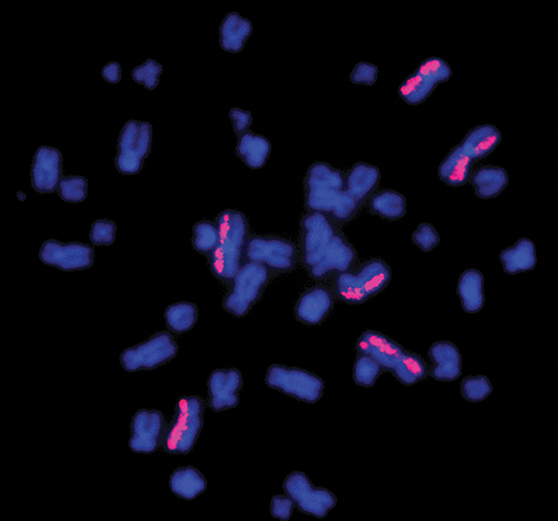 Damage to chromosomes shows up in fluorescent pink