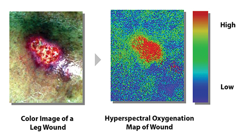 Color image of leg wound next to hyperspectral oxygenation map of the wound