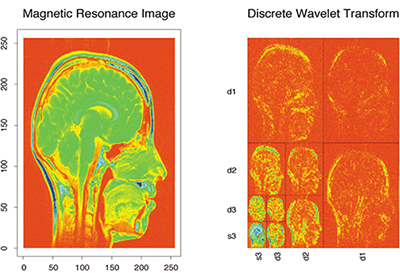 Magnetic Resonance image of a head and the discrete Wavelet Transform comparison