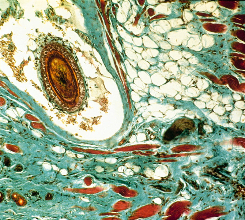 Stained rabbit skin pathology sample