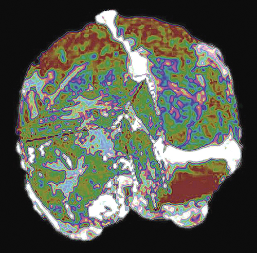brain segment scan in color