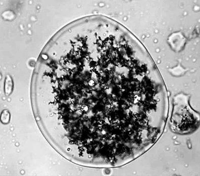 A closeup of an EZVI micell shows the zero-valent iron particles in a water-in-oil emulsion. The metal nanoparticles react with the contaminants, breaking apart their chemical bonds and releasing harmless molecules back into the ground. Credit: NASA A closeup of an EZVI micell