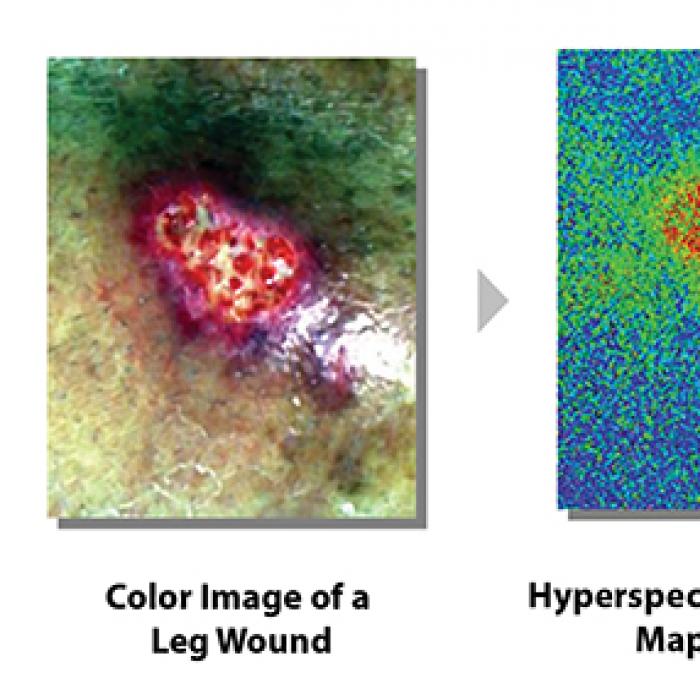 Color image of leg wound next to hyperspectral oxygenation map of the wound