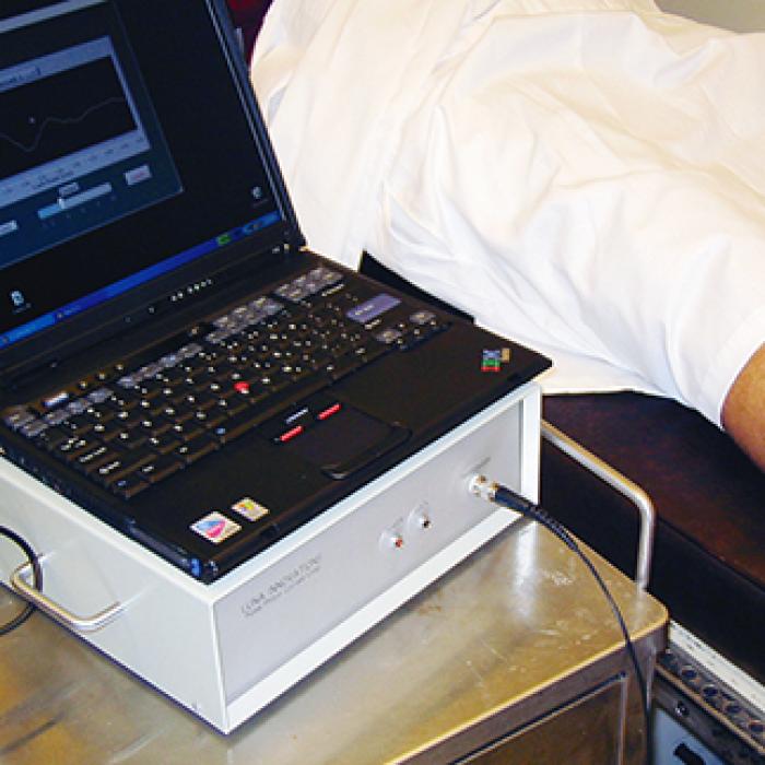 Luna’s current compartment syndrome prototype is now being tested for noninvasive diagnosis. A next-generation design will reduce the size of the unit by a fourth and increase functionality. Here, its is shown taking internal pressure reading. The most common method for performing this test is a painful biopsy. Luna’s compartment syndrome prototype