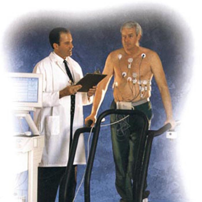 Illustration of the Microvolt T-Wave Alternans Test during exercise on a treadmill