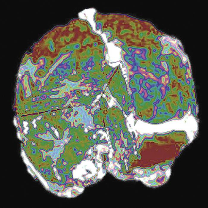 brain segment scan in color