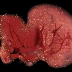 A CryoViz image shows stem cells tagged with fluorescent markers in a mouse liver. After a specimen, usually a mouse, is frozen in a block, the device shaves thin slices off the block, taking multiple high-resolution images of the block face to create a three-dimensional image showing the location of every tagged cell within the body. A CryoViz image showing tagged stem cells in a mouse liver