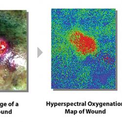 Color image of leg wound next to hyperspectral oxygenation map of the wound