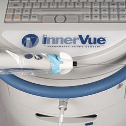 The InnerVue™ Diagnostic Scope System