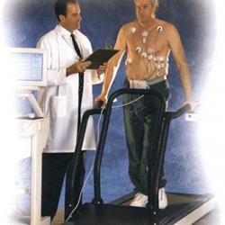 Illustration of the Microvolt T-Wave Alternans Test during exercise on a treadmill
