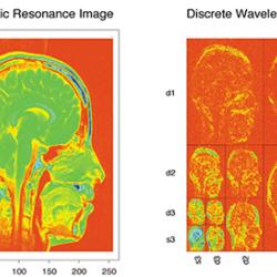 Magnetic Resonance image of a head and the discrete Wavelet Transform comparison